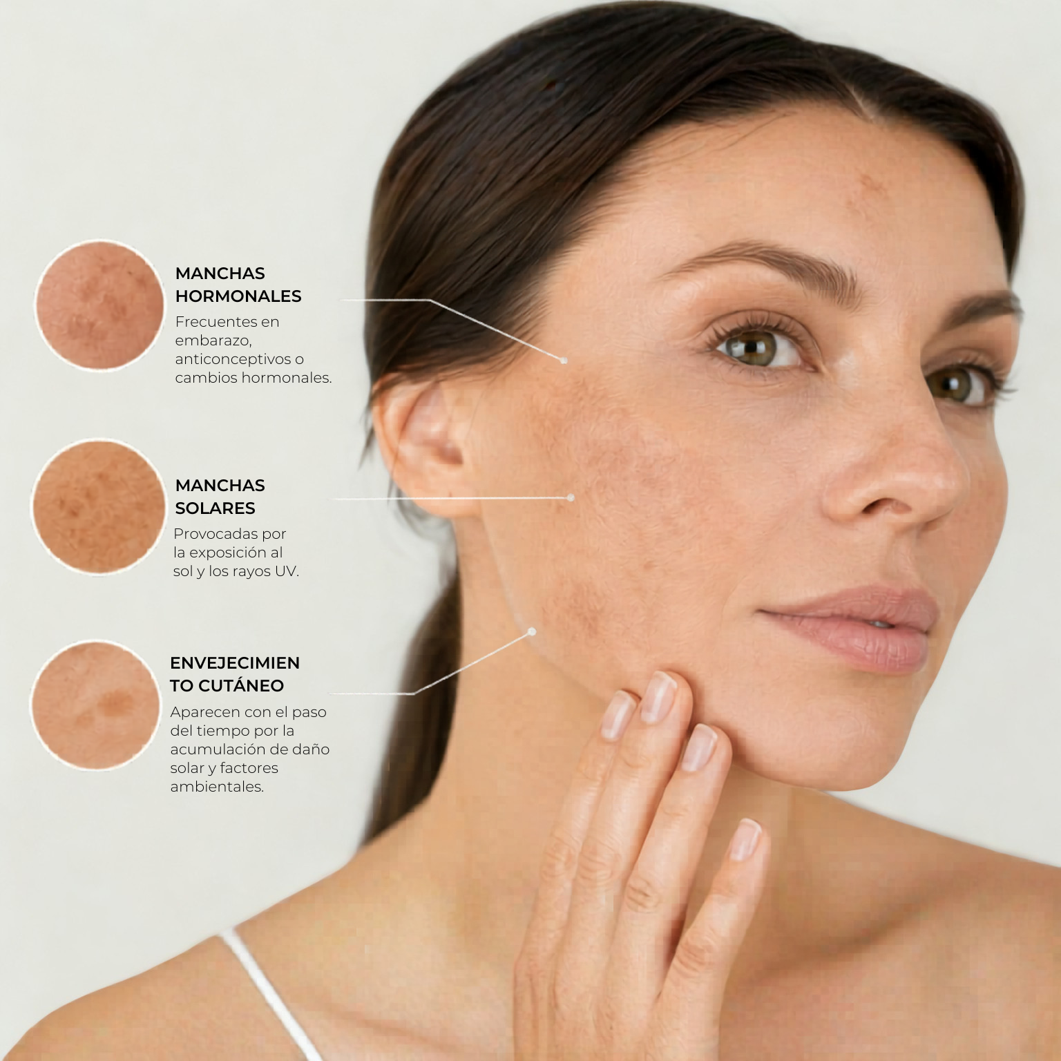 CÓMO ELIMINAR MANCHAS FACIALES: CAUSAS Y TRATAMIENTOS EFICACES